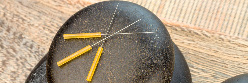 طب سوزنی یکی از سنت های چین است که از زمان های بسیار گذشته تا به الان مورد استفاده قرار گرفته است